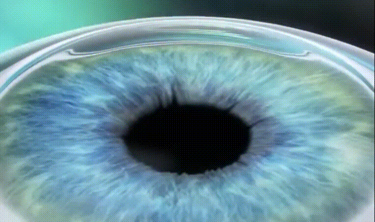 GIF Image